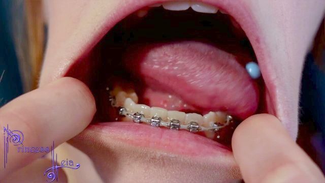 [aol] - Sounds Like Muthic To Me - Braces Obsession Cumshots Pmv